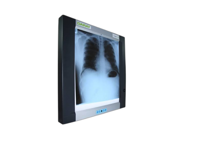 X-Ray Viewer
